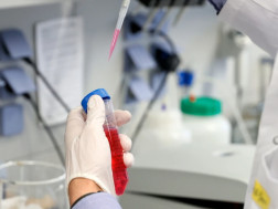 კორონავირუსი